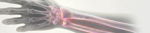 Osteopenia: qué es, causas y cómo los suplementos de calcio pueden ayudar