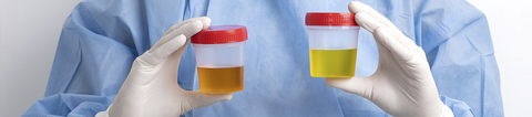 ¿Qué dice tu orina de tu salud? Guía sobre colores, olores y frecuencia