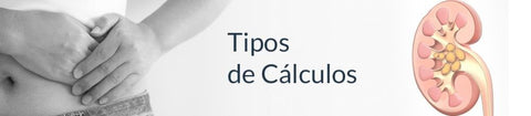 Tipos de Cálculos Renales