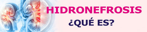 ¿Qué es la hidronefrosis?